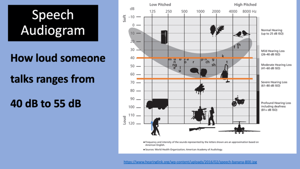 speech audiogram showing speech decibel range